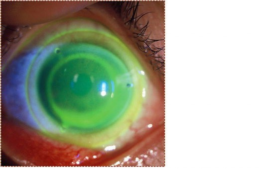 인터뷰 넥스트렌즈