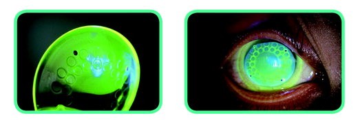 하이브리드렌즈 엠보싱11