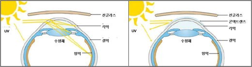 6면 콘택트 기획 관련 사진(자외선 차단)