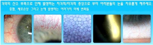 6면 콘택트 관련사진