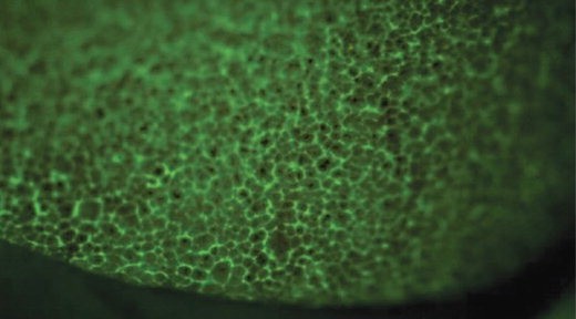 The Solution choice is clear-1