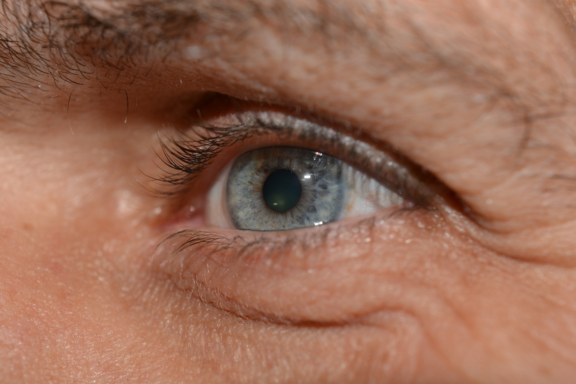 눈물이 닦아도 계속 나오는 것은 노인성 안구질환인 눈물길 막힘과 노인성 안구건조증 때문이다(사진=픽사베이)