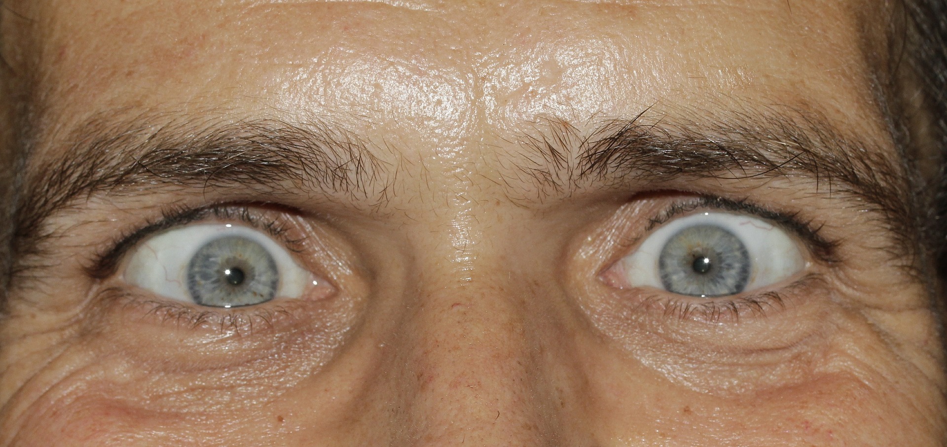 눈의 변화에 따라 건강상태를 알 수 있다(사진=픽사베이)