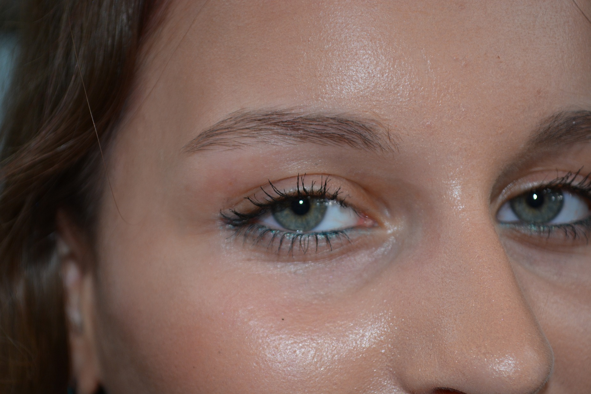 애교살 수술을 잘못 받으면 부작용이 나타난다 (사진=픽사베이)