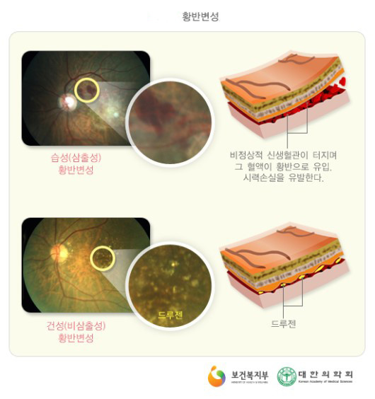 출처: 보건복지부, 대한의학회