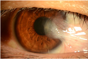 출처: 중앙대학교 병원