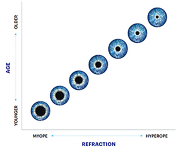 그림 2   나이와 굴절이상에 따른 동공크기 분포도